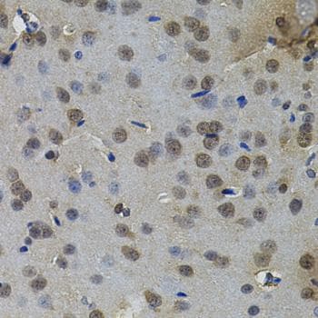 IL-33 Antibody