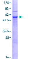 Human ENDOV Protein (Recombinant GST)