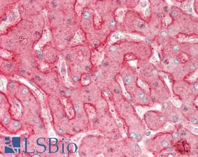 IHC-plus™ TSAP6 / STEAP3 Antibody