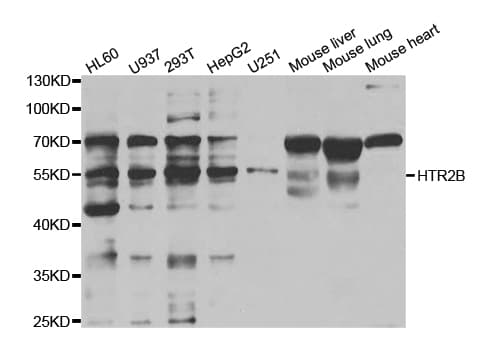 HTR2B / 5-HT2B Receptor Antibody