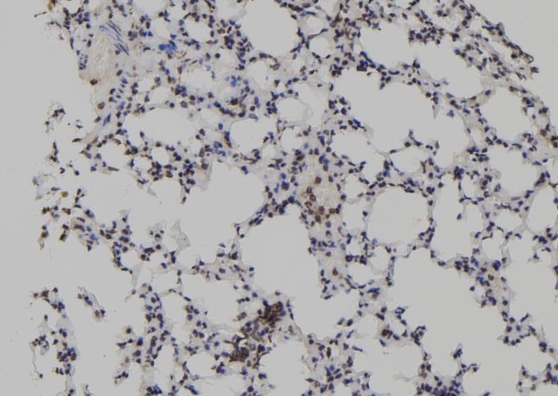 TET2 Antibody