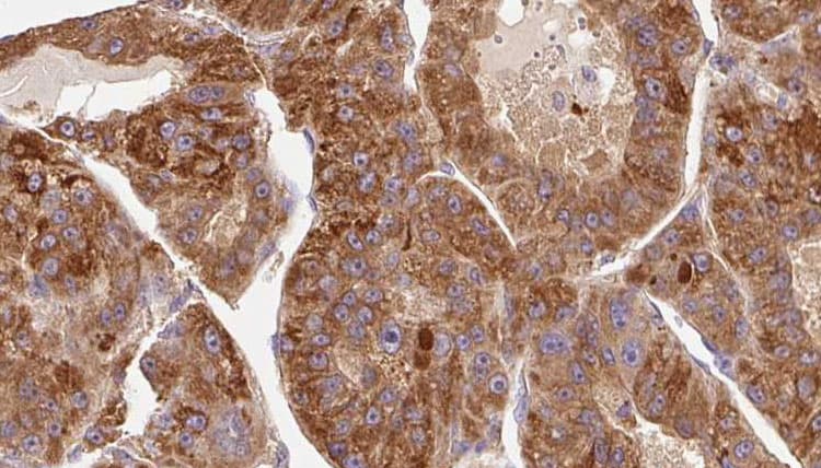 Polyclonal Rabbit anti-Human KIR3DL1 Antibody (IHC, IF, WB)