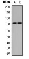 Polyclonal Rabbit anti-Human NCBP1 / CBP80 Antibody (N-Terminus, IHC, WB)
