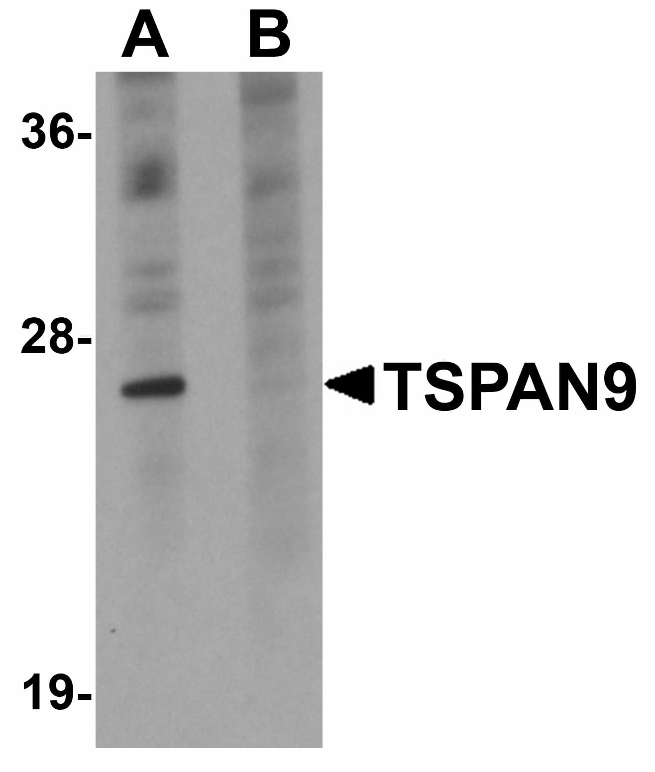 IHC-plus™ TSPAN9 Antibody