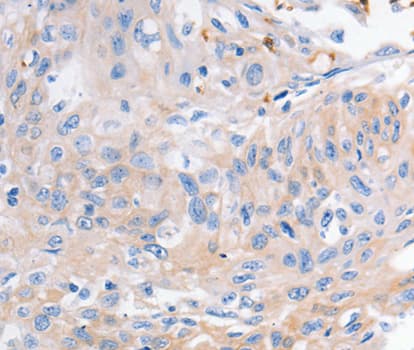 Polyclonal Rabbit anti-Human KCNA1 / Kv1.1 Antibody (IHC, WB)