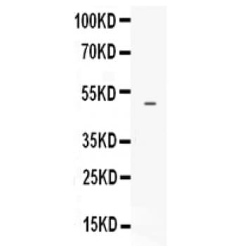 EDNRB / Endothelin B Receptor Antibody (aa406-439)