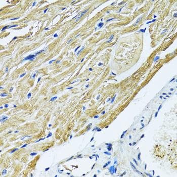 SLC5A6 / SMVT Antibody