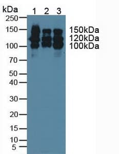 NCAM / CD56 Antibody (aa340-608)