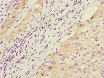 GTF2A2 / TFIIA Antibody