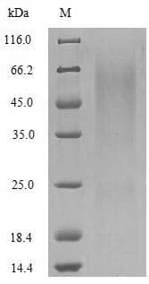 Outer capsid glycoprotein VP7 (Rotavirus A) (Recombinant 6His, N-terminus)