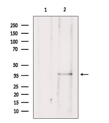 Polyclonal Rabbit anti-Human BCL10 / BCL-10 Antibody (IHC, WB)