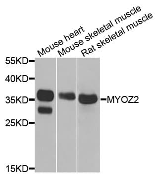 Polyclonal Rabbit anti-Human MYOZ2 / CS-1 Antibody (IHC, IF, WB)