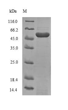 Human PSMB3 Protein (Recombinant GST, N-terminus)