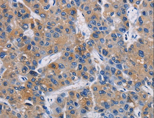 Polyclonal Rabbit anti-Human GPM6A / Glycoprotein M6A Antibody (IHC, WB)
