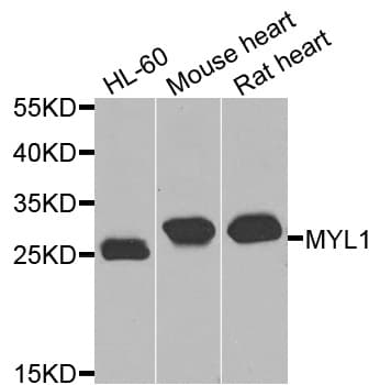 IHC-plus™ Polyclonal Rabbit anti-Human MLC3F / MYL1 Antibody (IHC, WB)