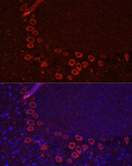 SLC1A1 / EAAT3 Antibody