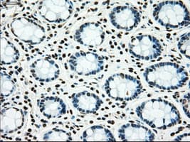 Monoclonal Mouse anti-Human MAP2K4 / MKK4 Antibody (clone OTI2E4, IHC, IF, WB)