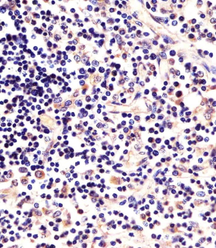 p56lck / LCK Antibody (clone 1526CT823.75.16)