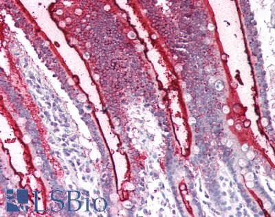 Polyclonal Rabbit anti-Human SI / Sucrase Isomaltase Antibody (aa1717-1827, IHC, WB)