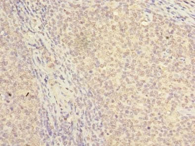 NKIRAS2 Antibody