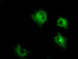 LOX / Lysyl Oxidase Antibody (clone OTI9G6)