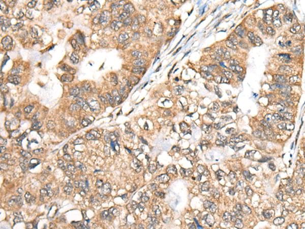 BLNK Antibody