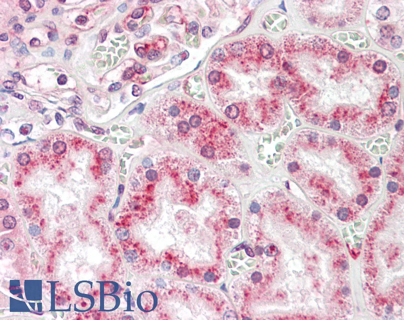 IHC-plus™ Polyclonal Rabbit anti-Human RNASET2 Antibody (IHC, IF, WB)