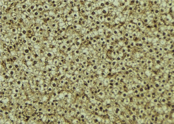HPSE / Heparanase Antibody