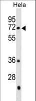 GALNT13 Antibody (aa252-281)