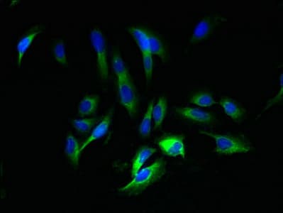 Polyclonal Rabbit anti-Human AMBP Antibody (IHC, WB)