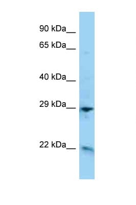 Polyclonal Rabbit anti-Human ADM / Adrenomedullin Antibody (C-Terminus, WB)