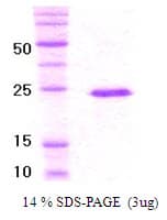 Human VHL / Von Hippel Lindau Protein (Recombinant His)