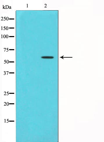Polyclonal Rabbit anti-Human CHEK1 / CHK1 Antibody (phospho-Ser280, IHC, IF, WB)