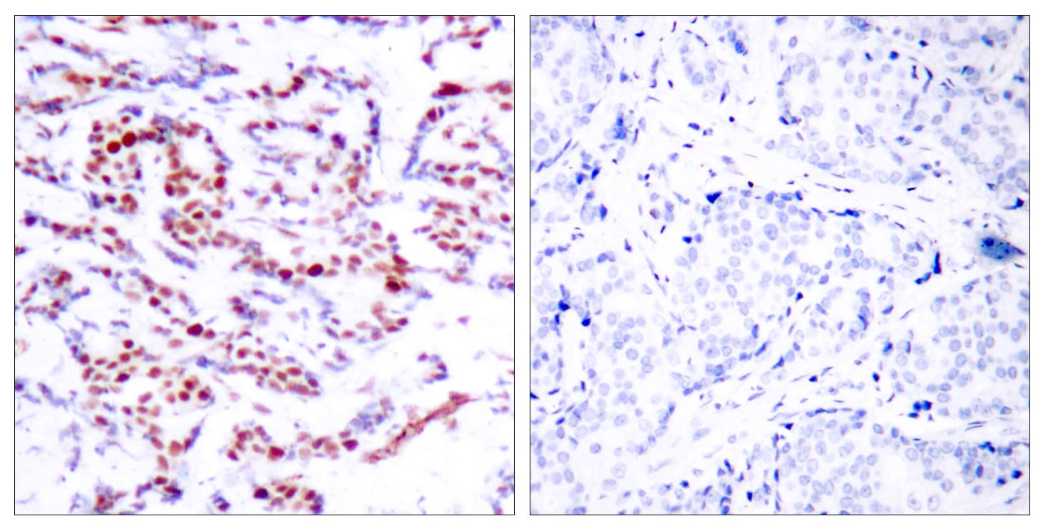 ATF2 Antibody (phospho-Ser112)