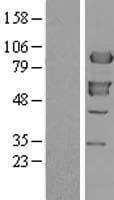 Human XRCC1 Protein (Over-Expression Lysate Myc-DDK (Flag))