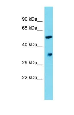 DHRS12 Antibody (aa173-222)