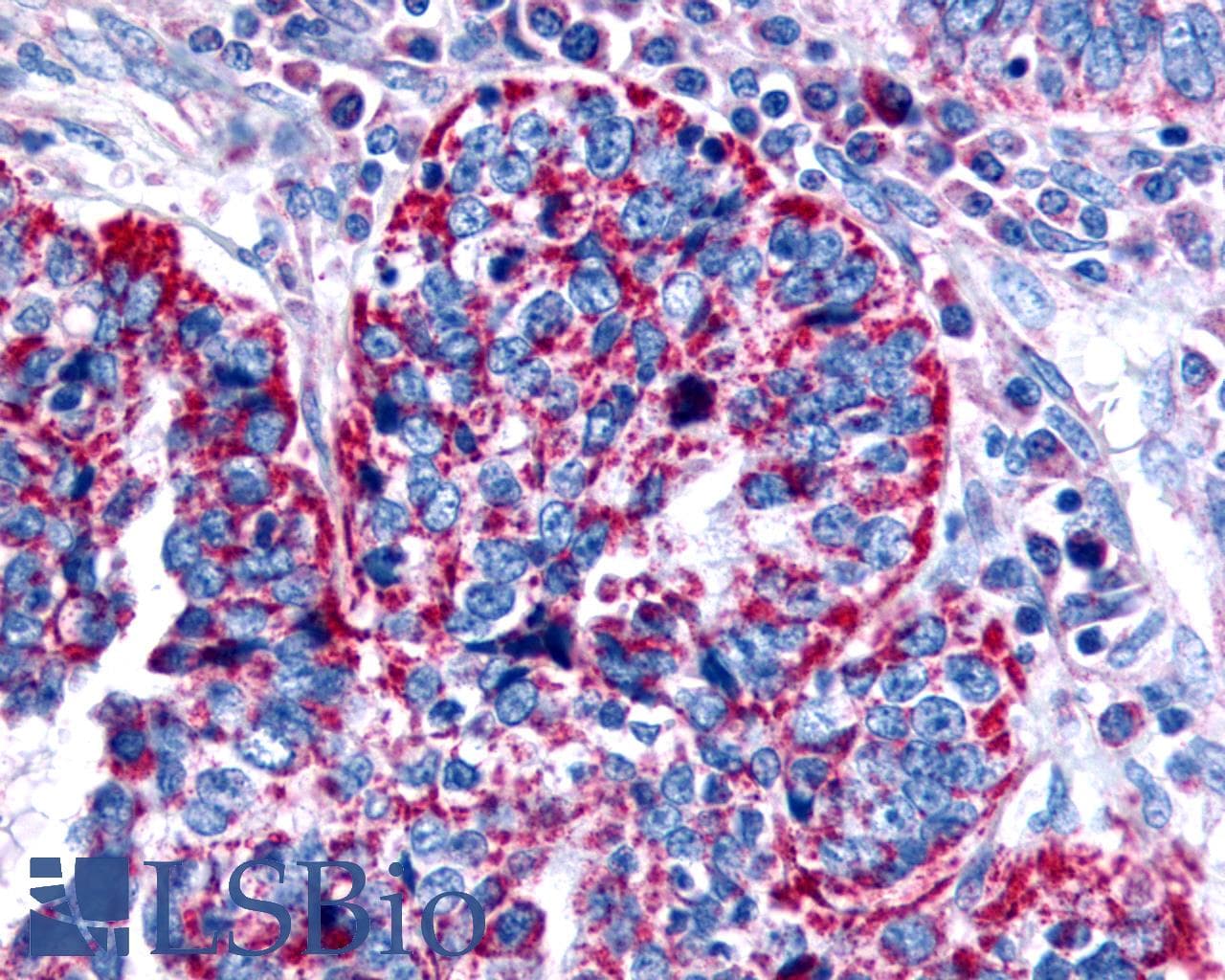 PathPlus™ CHRM2 / M2 Antibody (Cytoplasmic Domain)