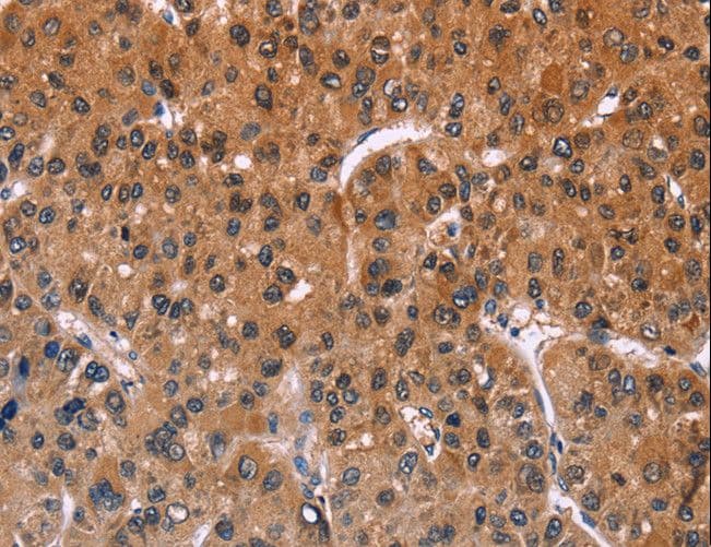 ING2 Antibody