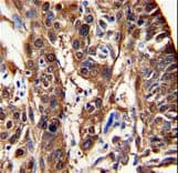 ALDH3A1 Antibody (aa69-99)