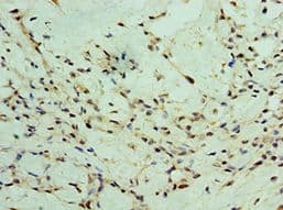 Polyclonal Rabbit anti-Human ZEB2 / SIP-1 Antibody (aa1050-1214, IHC)