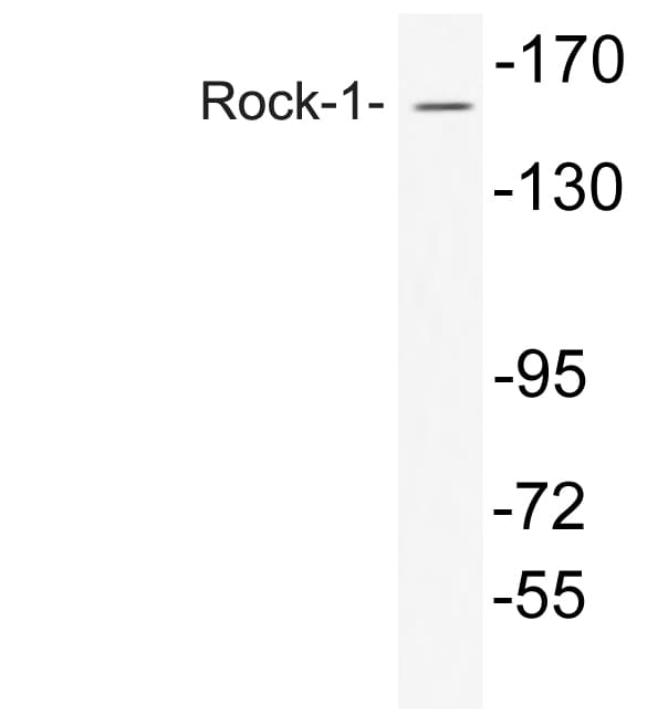 Rho Kinase / ROCK1 Antibody (Asn311)