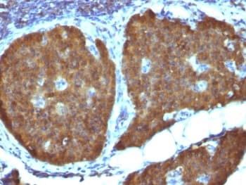 Monoclonal Mouse anti-Human ENO2 / NSE Antibody (clone ENO2/1462, Azide-free,BSA-free, IHC, IF)