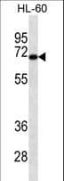 Monoclonal Mouse anti-Human HIPK4 Antibody (WB)
