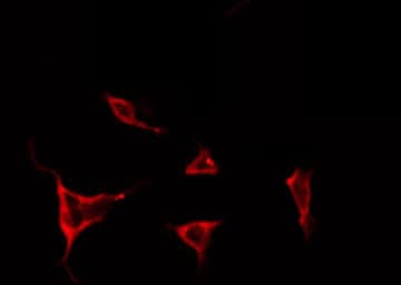 Polyclonal Rabbit anti-Human TIMP4 Antibody (IHC, IF, WB)