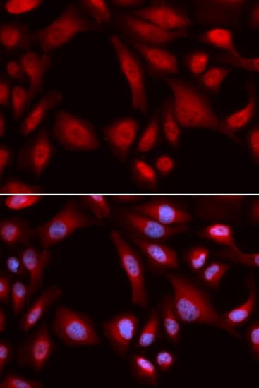 PSMD7 / MOV34 Antibody