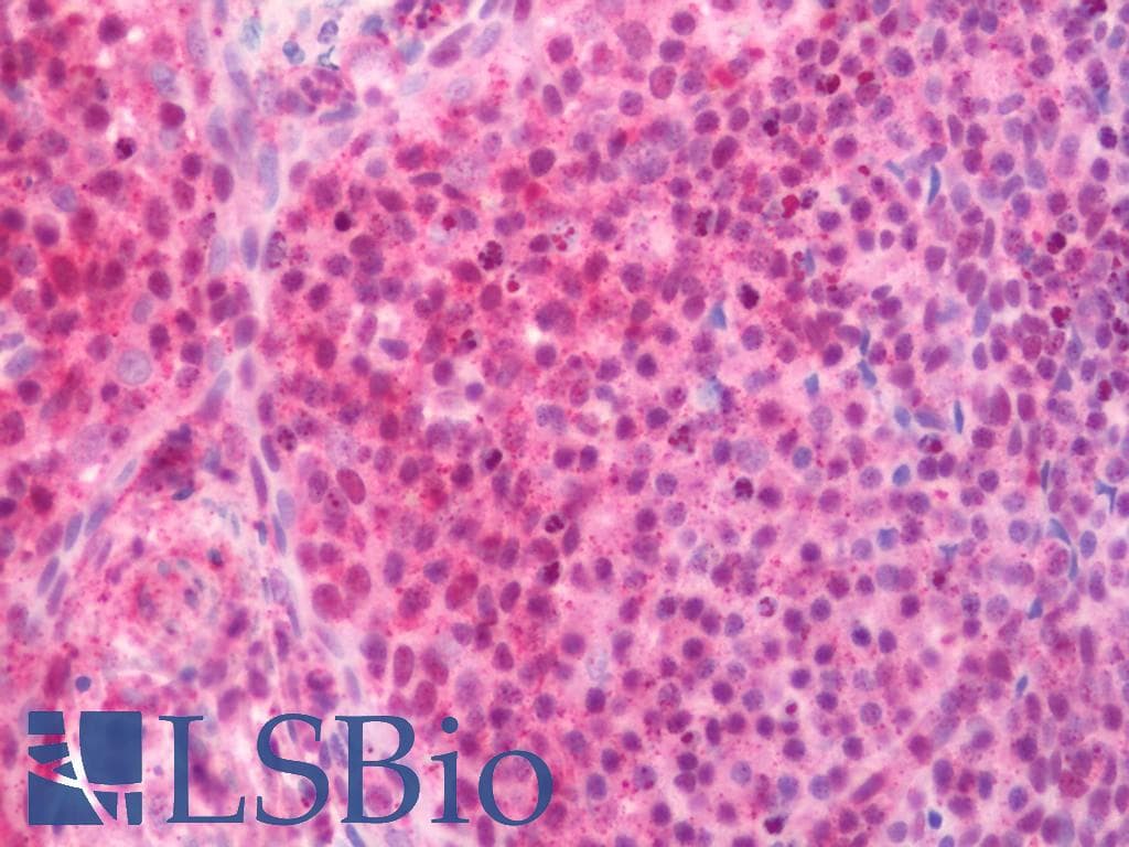 IHC-plus™ KLF17 Antibody