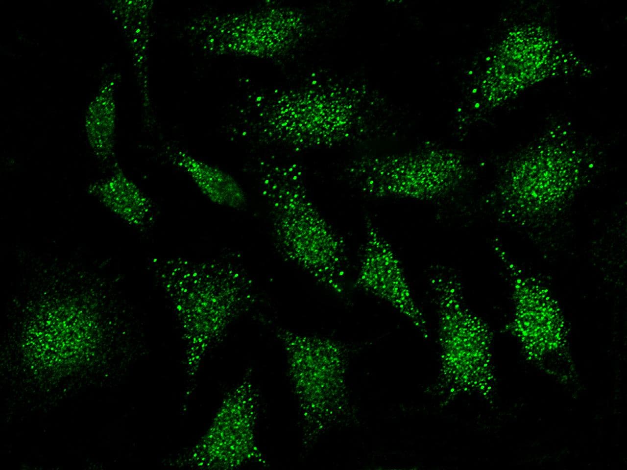 Polyclonal Rabbit anti-Human KDR / VEGFR2 / FLK1 Antibody (Preservative Free, IHC, IF)