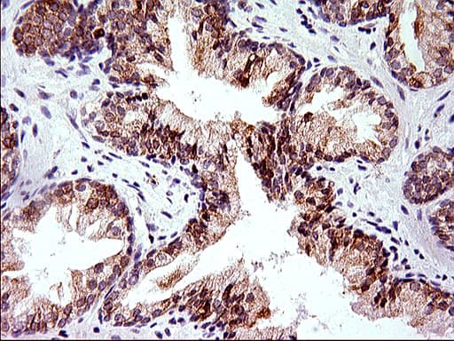HERPUD1 / HERP Antibody (clone OTI1A2)