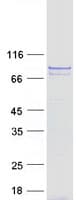Human COG7 Protein (Recombinant Myc-DDK (Flag))