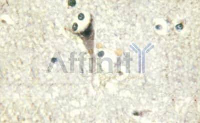 PRKCZ / PKC-Zeta Antibody